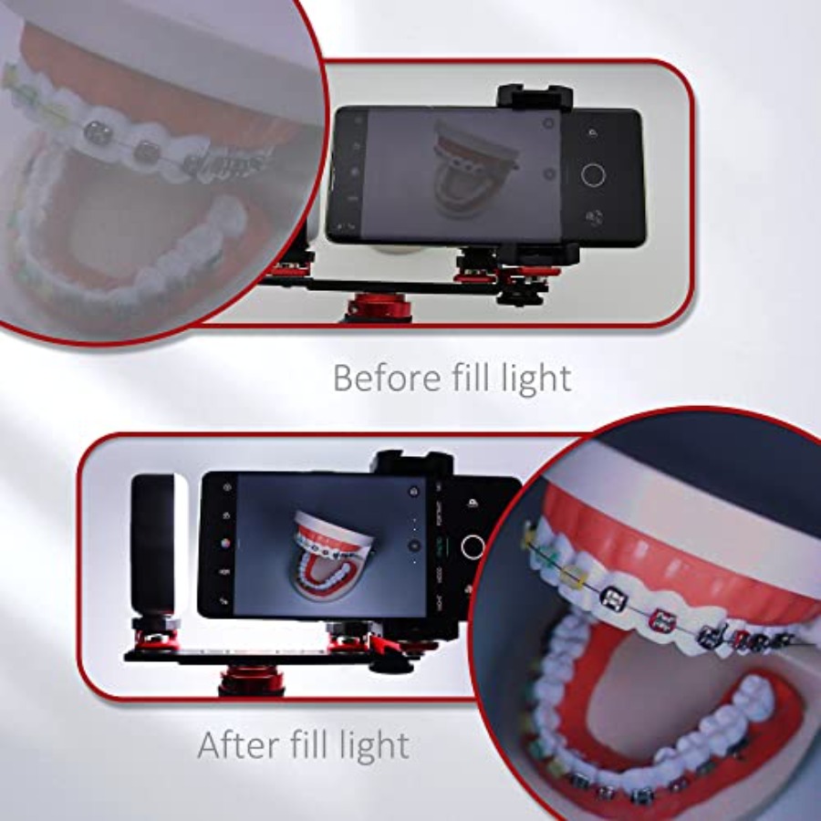 Bluetooth Dental Flash Light P - Photography Lighting Equipment ulasan dan harga