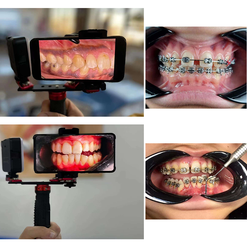 Dentistry Material Mobile Phon - Photography Mobile Lighting ulasan dan harga