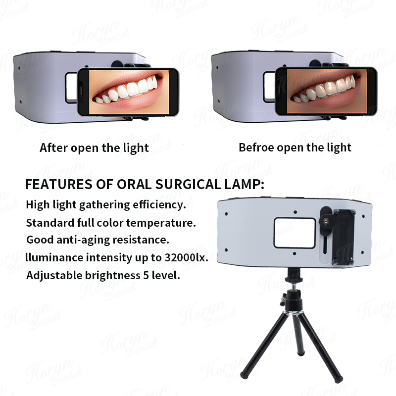Dental Flash Light Photography - Photography Lighting Equipment ulasan dan harga
